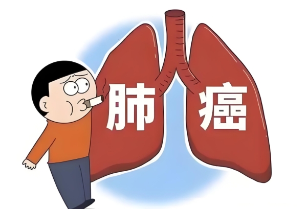 连续十年癌症死亡率第一！肺癌为何如此“凶狠”？
